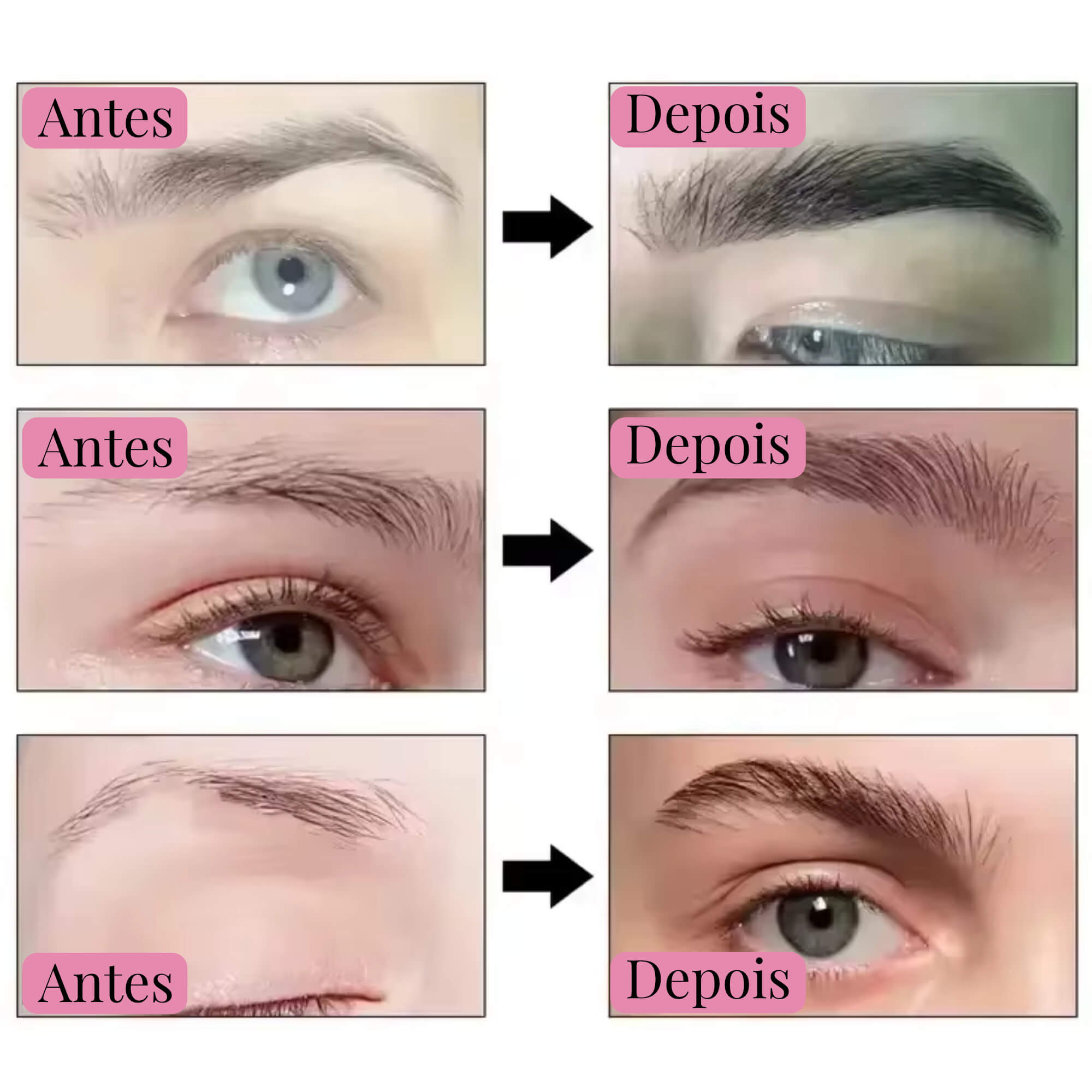 Lash Luxury: Sérum para crescimento rápido de cílios