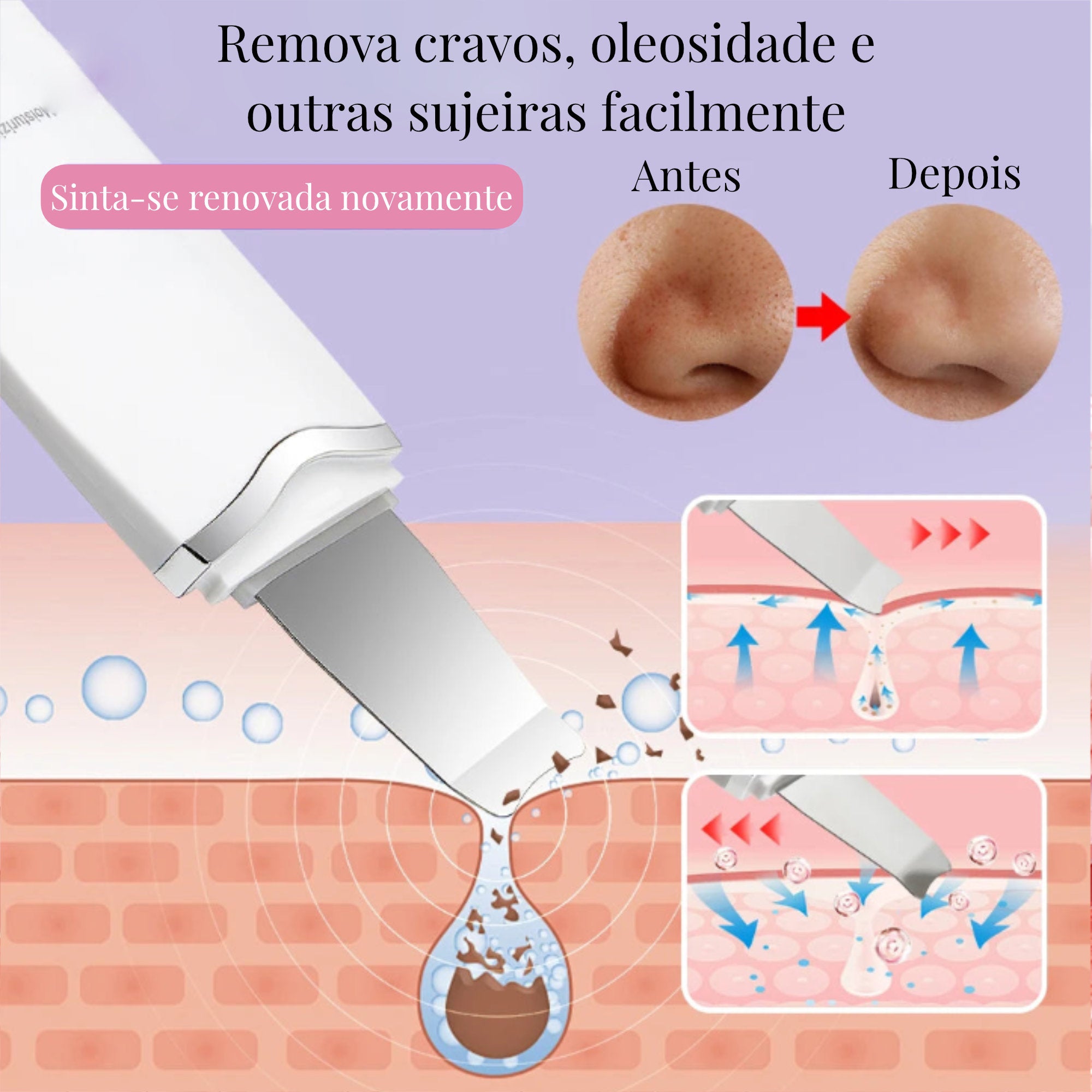 SkinClear Pro: Espátula facial ultrassônica